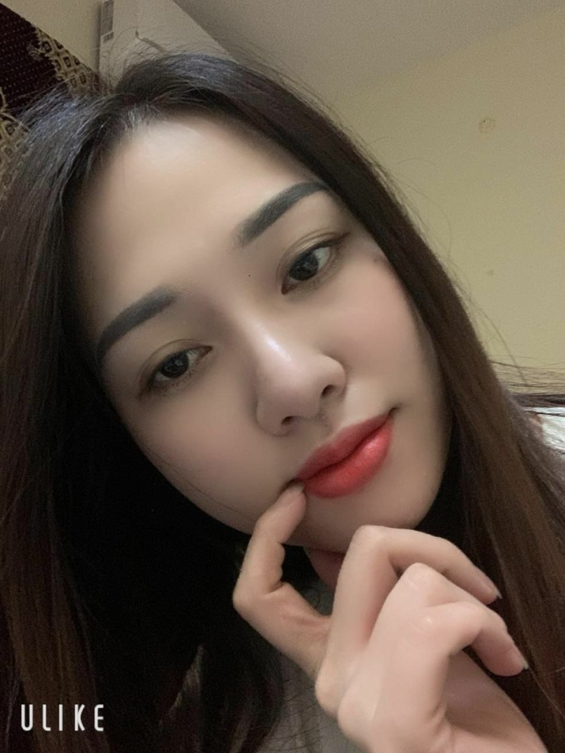 hana-anal-3